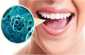 Патологии полости рта